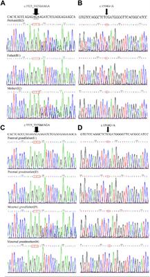 Case Report: The compound heterozygotes variants in FLT4 causes autosomal recessive hereditary lymphedema in a Chinese family